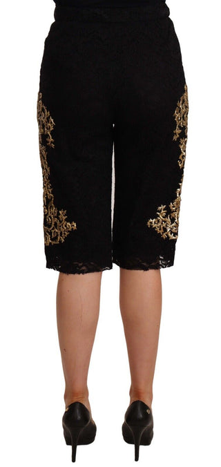 Elegant Knee Length Designer Shorts - Luxury for You