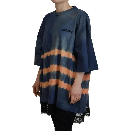 Blue Cotton Tie Dye Short Sleeves Lace T-shirt